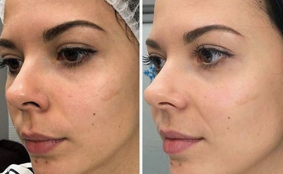 Before & After